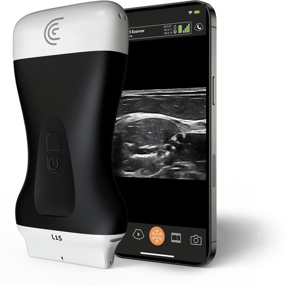 Ec Grafo De Mano L Hd Clarius Mobile Health Para Ecograf A