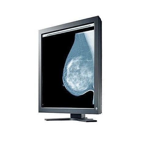 Monitor Mamogr Fico Gs Series Ultra Viol De Alta Definici N