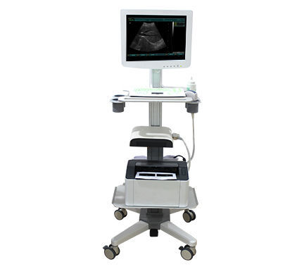 Ecógrafo con soporte compacto SS 100 Touch Screen Trolley Ultrasound