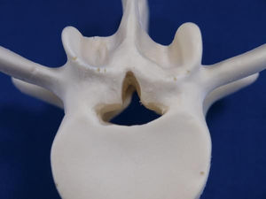 modelo anatómico disco intervertebral / vértebra lumbar / de formación / de patología