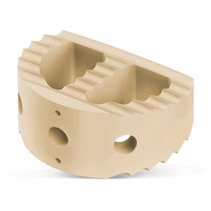 caja intersomática lumbar / vía anterior