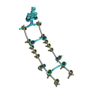 sistema de osteosíntesis occipitocervicotorácico / vía posterior / para adulto
