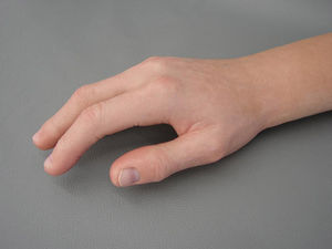 prótesis estética esterna antebrazo / para adulto