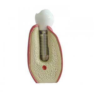 modelo anatómico para odontología / de demostración / de implantología