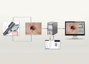 software de diagnóstico cutáneo / dermatología / para unidad de dermatología