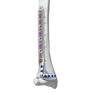 placa de compresión tibia / porción medial / porción distal