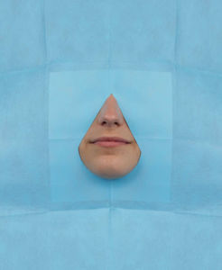 campo quirúrgico para cirugía maxilofacial / con abertura