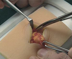 simulador cuidados dermatológicos / de cirugía / de patología / pad