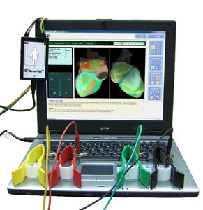 sistema de cartografía cardíaco / ECG