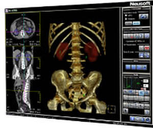 software de visualización / de análisis / urología / TDM
