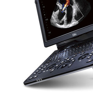 ecógrafo portátil / para ecografía cardiovascular / Doppler-color / consola integrada