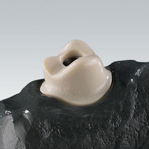 material dental de polímero acrílico / CAD CAM / para corona / para puente dental