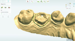 software de diseño / para odontología