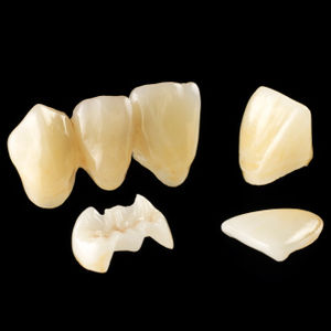 material dental de cerámica de vidrio / de disilicato de litio / para la restauración dental / CAD CAM