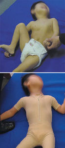 chaleco ortopédico de corrección postural / pediátrico