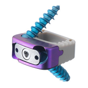 caja intersomática cervical / vía anterior