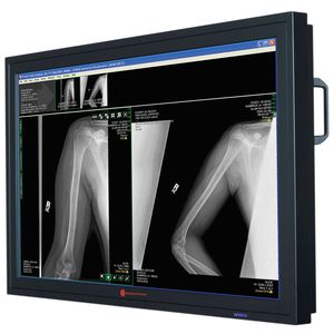 monitor para cirugía / de radiología / alta definición / LCD