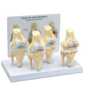 modelo anatómico rodilla / articulación / de patología