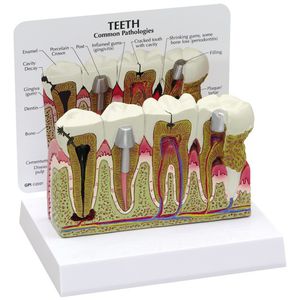 modelo anatómico dientes / de patología