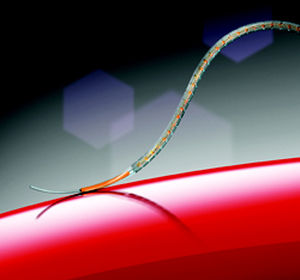 stent coronario / de dilución medicamentosa