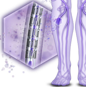 stent periférico / de dilución medicamentosa