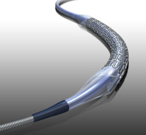 stent arteria renal / de cromo cobalto