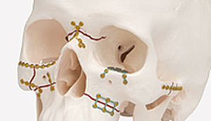kit de instrumentos para cirugía craneomaxilofacial