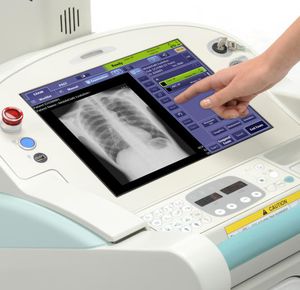 unidad móvil de radiografía digital