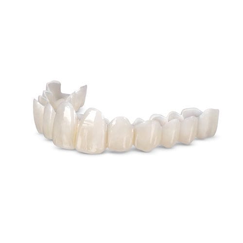 Prótesis dental de resina Smile Transitions Glidewell Europe de