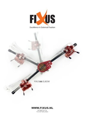 Fixus Photo 3
