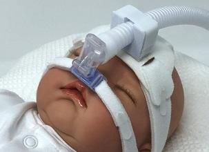 Máquina CPAP de cuidados intensivos neonatales - VX8000 - Viomedex ...