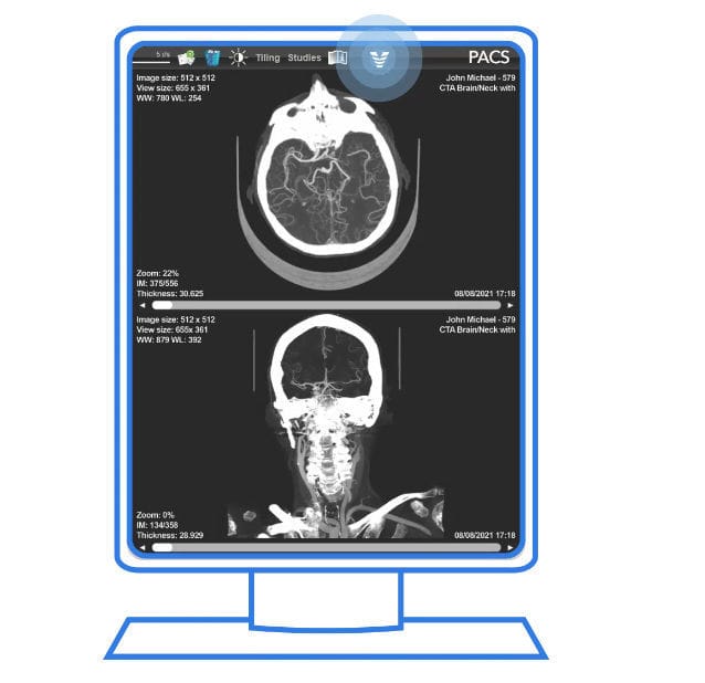 PACS con computación en la nube - Viz.ai - para imágenes médicas / médico