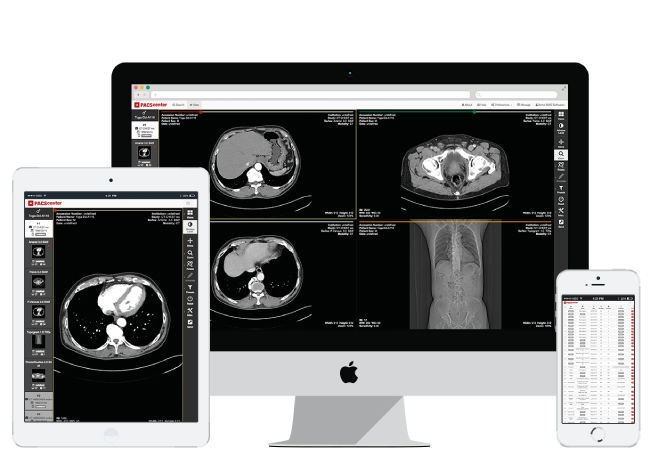 PACS para imágenes médicas - PACScenter - BMD Software - procesos ...