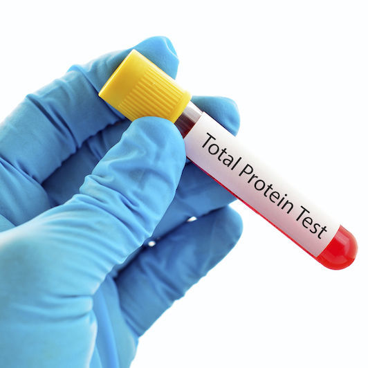 Reactivo de proteínas totales BIOMEDLabordiagnostik GmbH de suero / plasma / clínico