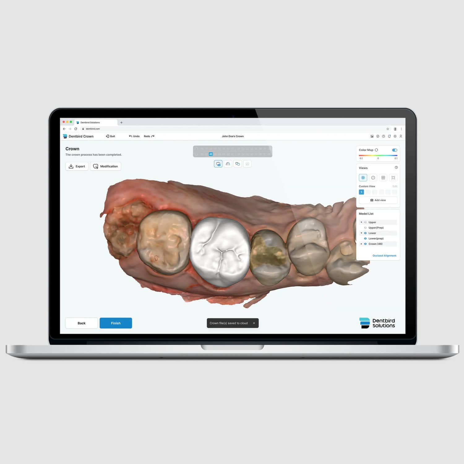 Software de diseño - Dentbird Crown - Imagoworks Inc. - de CAD / de ...