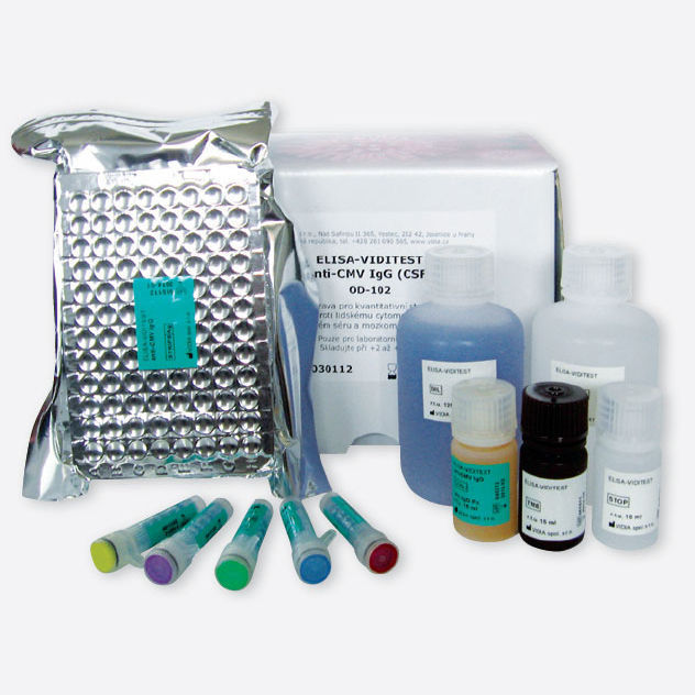 Kit De Prueba Para Enfermermedades Infecciosas Odz Series Vidia Sro De Igg De Igm 4999