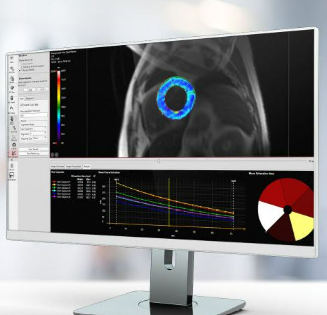 Software médico Pie Medical Imaging clínico / para IRM / de cardiología