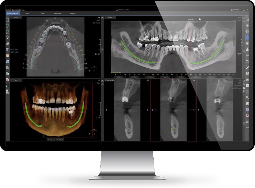 Software médico Xelis™ INFINITT North America para odontología