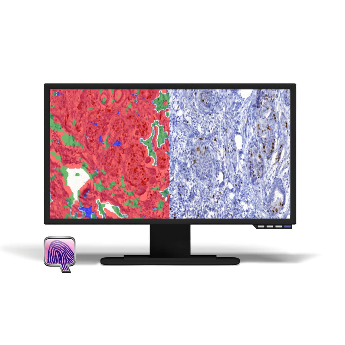 Módulo de software de análisis - PatternQuant - 3DHISTECH Ltd. - de ...