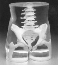 Fantoma de prueba de radiología / de abdomen