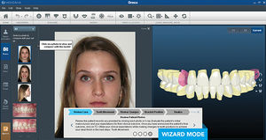software de diseño digital de la sonrisa