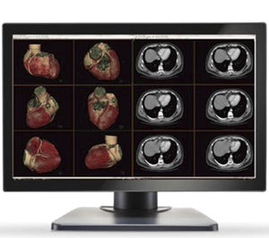 monitor de diagnóstico
