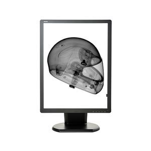 monitor médico 1