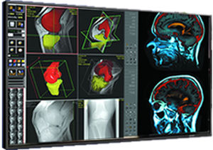 monitor médico 1