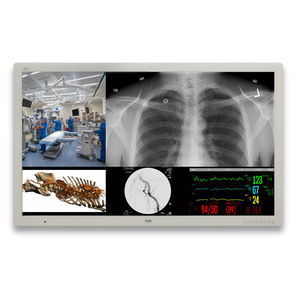monitor para sala de operaciones