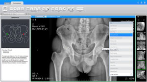 software de gestión / de medición / para imágenes médicas / clínico