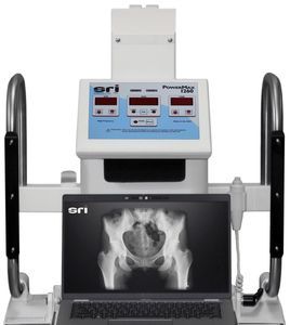 unidad móvil de radiografía DR