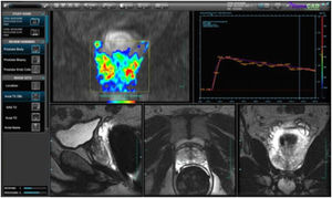 software para IRM