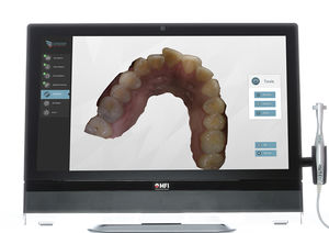 escáner 3D para clínica dental