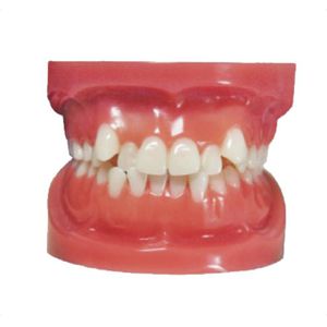 tipodonto de dentadura